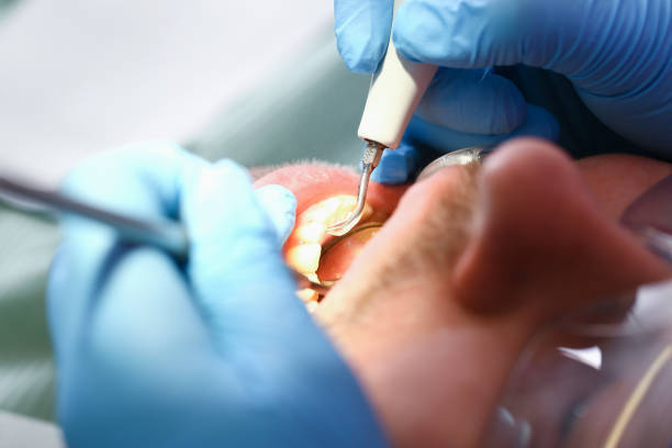 Best Emergency Broken Tooth Repair in Kitsap Lake, WA