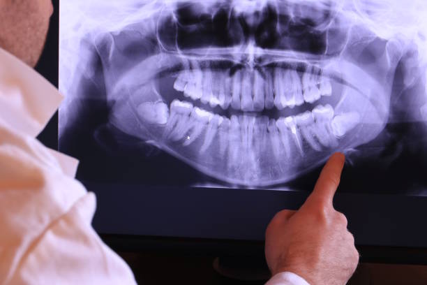Best Weekend Emergency Dentist in Kitsap Lake, WA