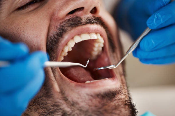 Best Pediatric Emergency Dentist in Kitsap Lake, WA